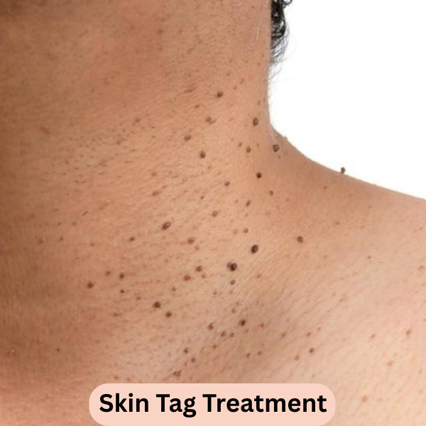 Hair Fall Treatment (6)